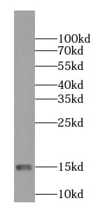 Western Blot: NDUFS5 Antibody (5C2) [NBP3-43006] - human kidney tissue were subjected to SDS PAGE followed by western blot with (NDUFS5 antibody) at dilution of 1:1000