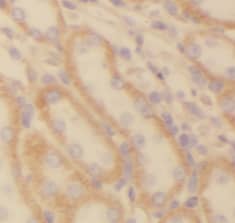 Immunohistochemistry: NDUFS5 Antibody (5C2) [NBP3-43006] - Immunohistochemistry of paraffin-embedded human kidney using (NDUFS5 antibody) at dilution of 1:50