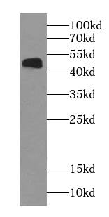 Western Blot: NOB1 Antibody (8G0) [NBP3-43007] - Jurkat cells were subjected to SDS PAGE followed by western blot with (NOB1 Antibody) at dilution of 1:3000