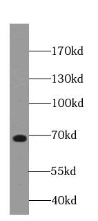 Western Blot: NUMBL Antibody (8E0) [NBP3-43009] - L02 cells were subjected to SDS PAGE followed by western blot with (NUMBL Antibody) at dilution of 1:1000