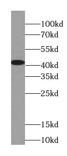 Western Blot: OXA1L Antibody (4F2) [NBP3-43011] - HepG2 cells were subjected to SDS PAGE followed by western blot with (OXA1L antibody) at dilution of 1:1000