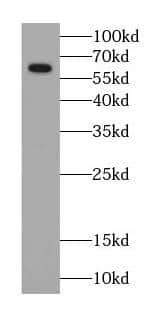 Western Blot: P4HA1 Antibody (4F1) [NBP3-43012] - PC-3 cells were subjected to SDS PAGE followed by western blot with (P4HA1 antibody) at dilution of 1:1000