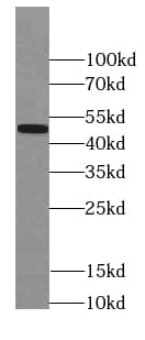 Western Blot: PAX1 Antibody (8D9) [NBP3-43013] - K-562 cells were subjected to SDS PAGE followed by western blot with (PAX1 Antibody) at dilution of 1:1000