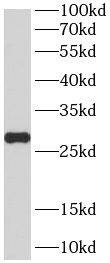 Western Blot: PCMT1 Antibody (7G6) [NBP3-43014] - HeLa cells were subjected to SDS PAGE followed by western blot with (PCMT1 Antibody) at dilution of 1:1000