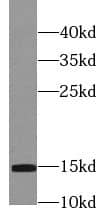 Western Blot: Profilin 2 Antibody (5D4) [NBP3-43015] - mouse brain tissue were subjected to SDS PAGE followed by western blot with (Profilin 2 Antibody) at dilution of 1:2000