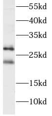 Western Blot: PGRMC2 Antibody (0C11) [NBP3-43017] - HeLa cells were subjected to SDS PAGE followed by western blot with (PGRMC2 antibody) at dilution of 1:1000