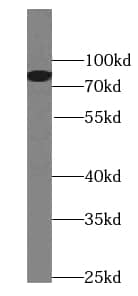 Western Blot: PLAP Antibody (8F0) [NBP3-43019] - ROS1728 cells were subjected to SDS PAGE followed by western blot with (PLAP Antibody) at dilution of 1:1000