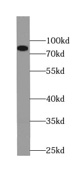 Western Blot: PLOD3 Antibody (2B1) [NBP3-43020] - human placenta tissue were subjected to SDS PAGE followed by western blot with (PLOD3 antibody) at dilution of 1:300