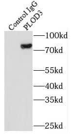 Immunoprecipitation: PLOD3 Antibody (2B1) [NBP3-43020] - IP Result of anti-PLOD3 (IP:FNab06554, 5ug; Detection:FNab06554 1:500) with HeLa cells lysate 1400ug.