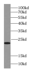 Western Blot RAB18 Antibody (1G11)