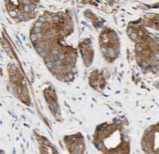 Immunohistochemistry RAB18 Antibody (1G11)