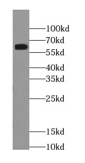 Western Blot: RABEP2 Antibody (2F7) [NBP3-43022] - PC-3 cells were subjected to SDS PAGE followed by western blot with (RABEP2 antibody) at dilution of 1:300