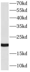 Western Blot: RAC2 Antibody (8F0) [NBP3-43023] - Jurkat cells were subjected to SDS PAGE followed by western blot with (RAC2 antibody) at dilution of 1:10000