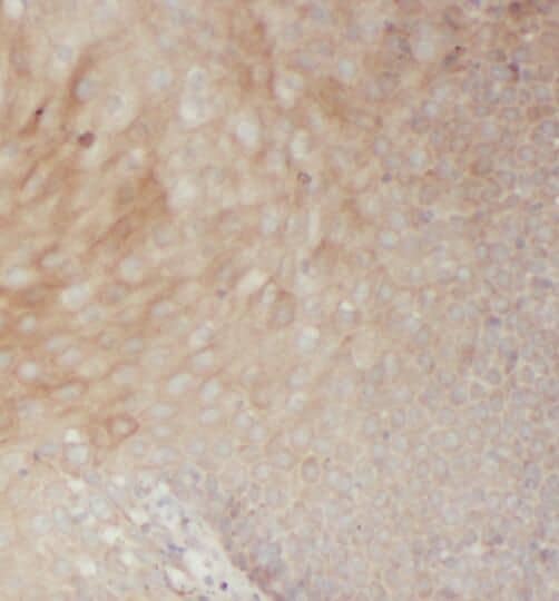 Immunohistochemistry: RAC2 Antibody (8F0) [NBP3-43023] - Immunohistochemistry of paraffin-embedded human spleen slide using (RAC2 Antibody) at dilution of 1:50