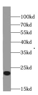 Western Blot: RBBP9 Antibody (0B7) [NBP3-43024] - A549 cells were subjected to SDS PAGE followed by western blot with (RBBP9 antibody) at dilution of 1:500