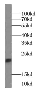 Western Blot: RBBP9 Antibody (7E10) [NBP3-43025] - A549 cells were subjected to SDS PAGE followed by western blot with (RBBP9 antibody) at dilution of 1:500