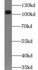 Western Blot: RBM15 Antibody (6B1) [NBP3-43026] - HeLa cells were subjected to SDS PAGE followed by western blot with (RBM15 antibody) at dilution of 1:1000