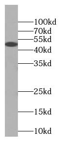 Western Blot: RISC Antibody (1C4) [NBP3-43028] - human testis tissue were subjected to SDS PAGE followed by western blot with (RISC antibody) at dilution of 1:1000