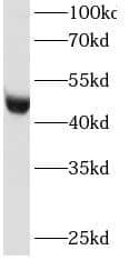 Western Blot: Ribonuclease Inhibitor Antibody (0H7) [NBP3-43029] - Hela cells were subjected to SDS PAGE followed by western blot with (Ribonuclease Inhibitor antibody) at dilution of 1:2000