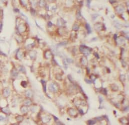 Immunohistochemistry EXOC2 Antibody (0H2)