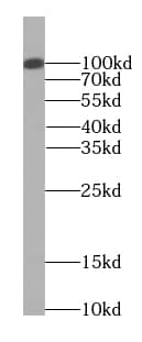 Western Blot EXOC2 Antibody (0H2)