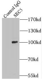 Immunoprecipitation EXOC2 Antibody (0H2)