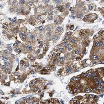 Immunohistochemistry Septin-2 Antibody (8H4) - BSA Free