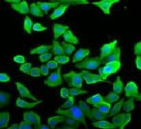 Immunocytochemistry/ Immunofluorescence: Septin-2 Antibody (8H4) [NBP3-43032] - Immunofluorescence analysis of U2OS cells using Septin-2 antibody (FNab07722). Blue: DAPI for nuclear staining.