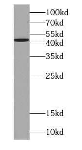 Western Blot: Septin-2 Antibody (8H4) [NBP3-43032] - HEK-293 cells were subjected to SDS PAGE followed by western blot with (Septin-2 Antibody) at 1:8000.
