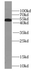 Western Blot: Septin-8 Antibody (9H10) [NBP3-43033] - HeLa cells were subjected to SDS PAGE followed by western blot with (Septin-8 Antibody) at dilution of 1:1000