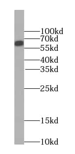 Western Blot: SMARCD1 Antibody (1A7) [NBP3-43035] - Jurkat cells were subjected to SDS PAGE followed by western blot with (SMARCD1 antibody) at dilution of 1:1000