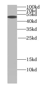 Western Blot: BAF57 Antibody (1G10) [NBP3-43036] - Jurkat cells were subjected to SDS PAGE followed by western blot with (BAF57 Antibody) at dilution of 1:1000