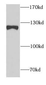 Western Blot: SND1 Antibody (0A1) [NBP3-43037] - HeLa cells were subjected to SDS PAGE followed by western blot with (SND1 Antibody) at dilution of 1:1000