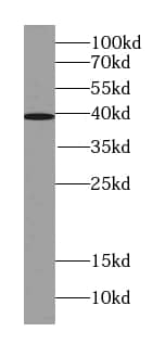 Western Blot: ST6 Sialyltransferase 6/ST6GALNAC6 Antibody (1F4) [NBP3-43040] - COLO 320 cells were subjected to SDS PAGE followed by western blot with (ST6 Sialyltransferase 6/ST6GALNAC6 Antibody) at dilution of 1:500