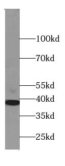 Western Blot: SLP-2 Antibody (5D10) [NBP3-43042] - HepG2 cells were subjected to SDS PAGE followed by western blot with (SLP-2 antibody) at dilution of 1:1000