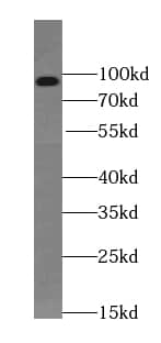 Western Blot: TEL2 Antibody (8B6) [NBP3-43043] - A431 cells were subjected to SDS PAGE followed by western blot with (TEL2 antibody) at dilution of 1:500