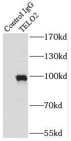 Immunoprecipitation: TEL2 Antibody (8B6) [NBP3-43043] - IP Result of anti-TEL2 (IP:FNab08592, 4ug; Detection:FNab08592 1:500) with HepG2 cells lysate 2900ug.