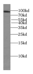 Western Blot: TFIP11 Antibody (3H5) [NBP3-43044] - HeLa cells were subjected to SDS PAGE followed by western blot with (TFIP11 antibody) at dilution of 1:1000