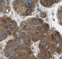 Immunohistochemistry: TIMM44 Antibody (0E2) [NBP3-43045] - Immunohistochemistry of paraffin-embedded human liver tissue slide using (TIMM44 Antibody) at dilution of 1:50