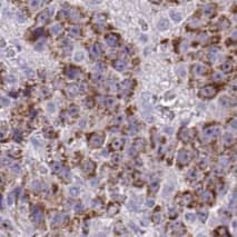Immunohistochemistry: TMEM70 Antibody (4F2) [NBP3-43047] - Immunohistochemistry of paraffin-embedded human liver using (TMEM70 antibody) at dilution of 1:50