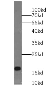 Western Blot: TMEM70 Antibody (4F2) [NBP3-43047] - A2780 cells were subjected to SDS PAGE followed by western blot with (TMEM70 antibody) at dilution of 1:500