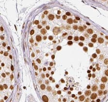 Immunohistochemistry Tripeptidyl peptidase II Antibody (4A3) - BSA Free