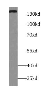 Western Blot Tripeptidyl peptidase II Antibody (4A3) - BSA Free