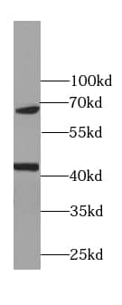 Western Blot: RNA polymerase I termination factor Antibody (7C4) [NBP3-43049] - HeLa cells were subjected to SDS PAGE followed by western blot with (RNA polymerase I termination factor antibody) at dilution of 1:2000