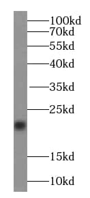 Western Blot: transgelin 2 Antibody (7D0) [NBP3-43050] - K-562 cells were subjected to SDS PAGE followed by western blot with (transgelin 2 antibody) at dilution of 1:1000