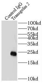 Immunoprecipitation: transgelin 2 Antibody (7D0) [NBP3-43050] - IP Result of anti-Transgelin 2 (IP:FNab08933, 4ug; Detection:FNab08933 1:1000) with HEK-293 cells lysate 1000ug.