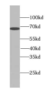 Western Blot: Transketolase Antibody (4E2) [NBP3-43051] - human brain tissue were subjected to SDS PAGE followed by western blot with (Transketolase antibody) at dilution of 1:1000