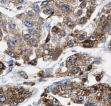 Immunohistochemistry: Transketolase Antibody (4E2) [NBP3-43051] - Immunohistochemistry of paraffin-embedded human liver using (Transketolase antibody) at dilution of 1:50