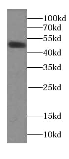 Western Blot: TRIM44 Antibody (9A2) [NBP3-43053] - MCF-7 cells were subjected to SDS PAGE followed by western blot with (TRIM44 Antibody) at dilution of 1:1000