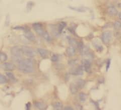 Immunohistochemistry TRUSS Antibody (1C0) - BSA Free